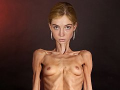 Free nude photos of anorexic women